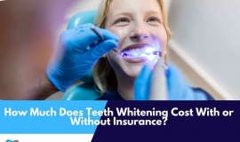 Can Teeth Lighten Damage Enamel? Fact & Suggestions Exposed