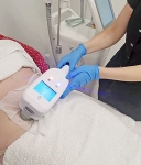 Coolsculpting For Body Contouring Tummy, Thighs And More
