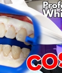 How Long Do Teeth Whitening Results Usually Last?