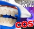 How Long Do Teeth Whitening Results Usually Last?