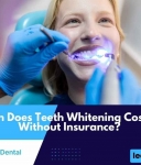 Can Teeth Lighten Damage Enamel? Fact & Suggestions Exposed