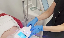 Coolsculpting For Body Contouring Tummy, Thighs And More