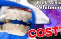 How Long Do Teeth Whitening Results Usually Last?