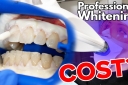 How Long Do Teeth Whitening Results Usually Last?