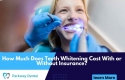 Can Teeth Lighten Damage Enamel? Fact & Suggestions Exposed